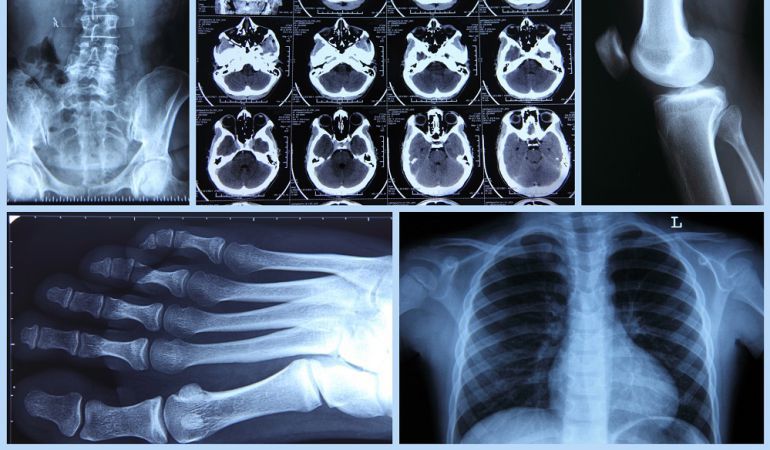 El PSOE de la Marina Baixa denuncia que las derivaciones a hospitales privados de Benidorm se han multiplicado por cuatro